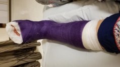 purple cast 06-2017